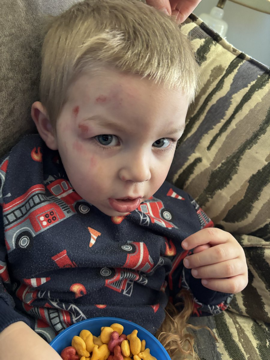 Our little man fell down our new porch stairs today. He’s never fallen down stairs before (2.5 yo). We think his boot came loose and tripped him up.

Thanking the Lord he is okay. He is in good spirits.