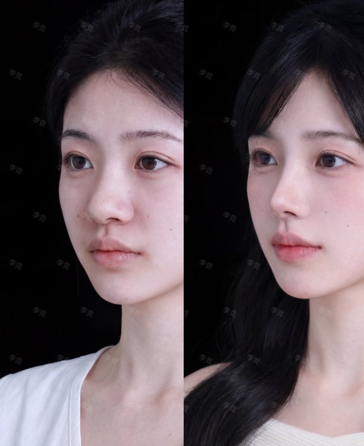 課金ちゃん tweet media