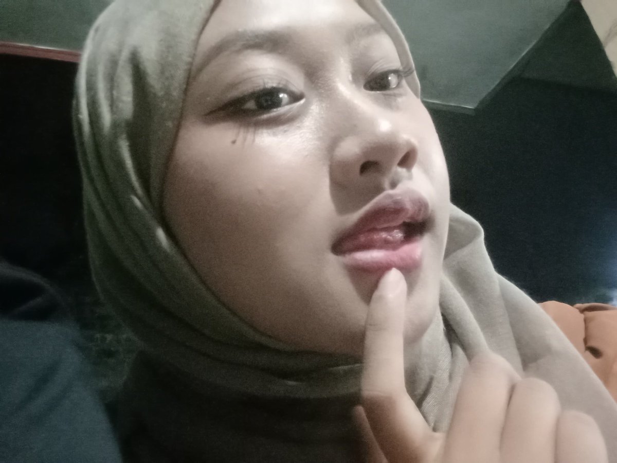 dumb.ice tweet media