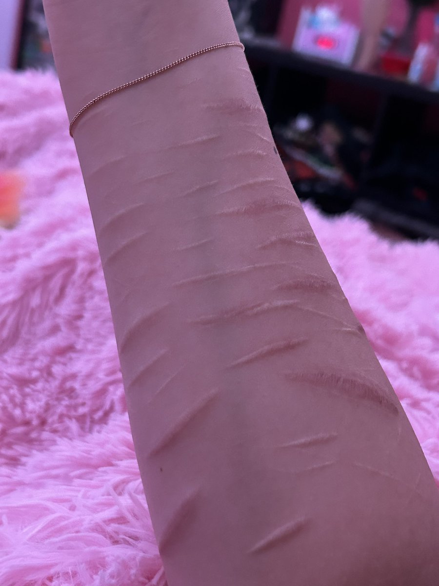 ♫ 𝕜𝕛 ♫ 𝕤𝕙𝕖𝕕𝕥𝕨𝕥 tweet media