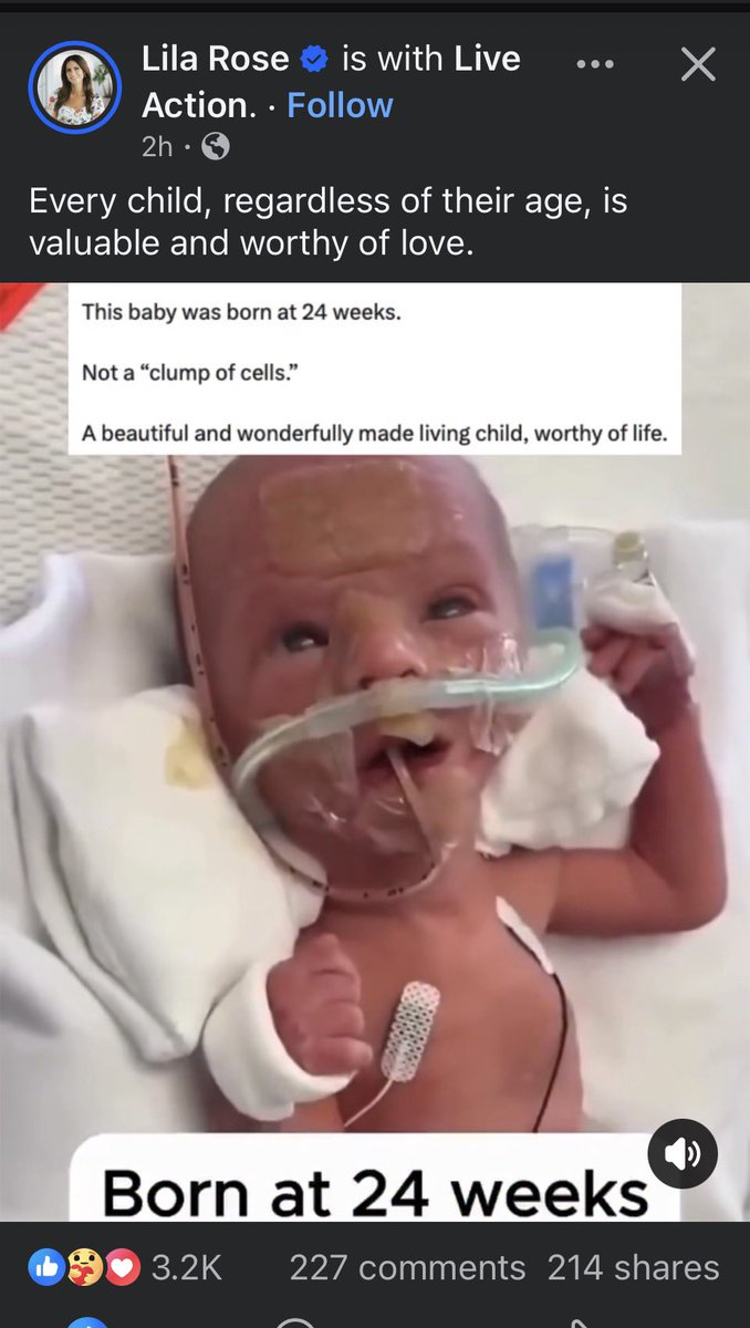 🐸 🌞 Sunshine 🌞 🐸 tweet media