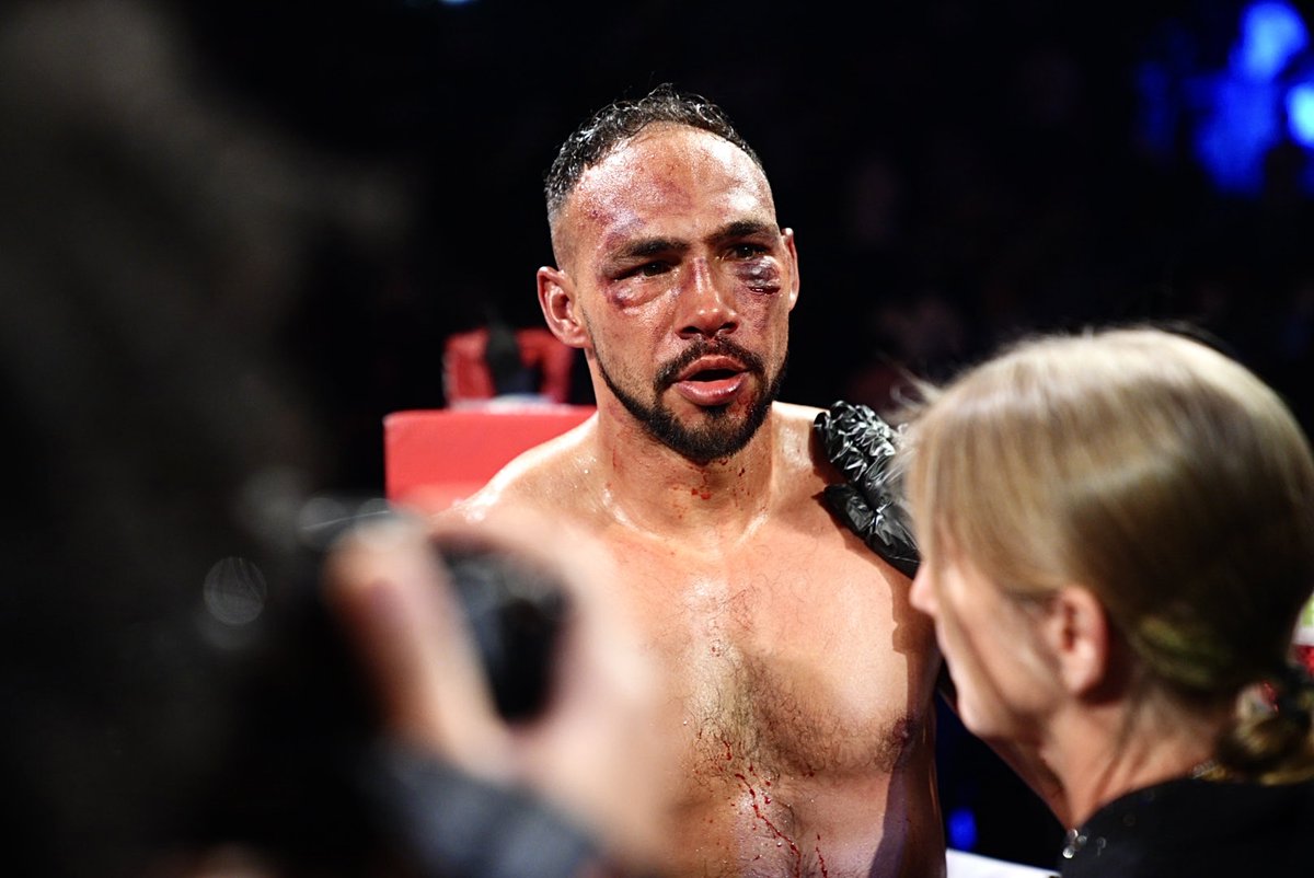 premierboxing's tweet image. The Aftermath. 🩸 #FundoraThurman
