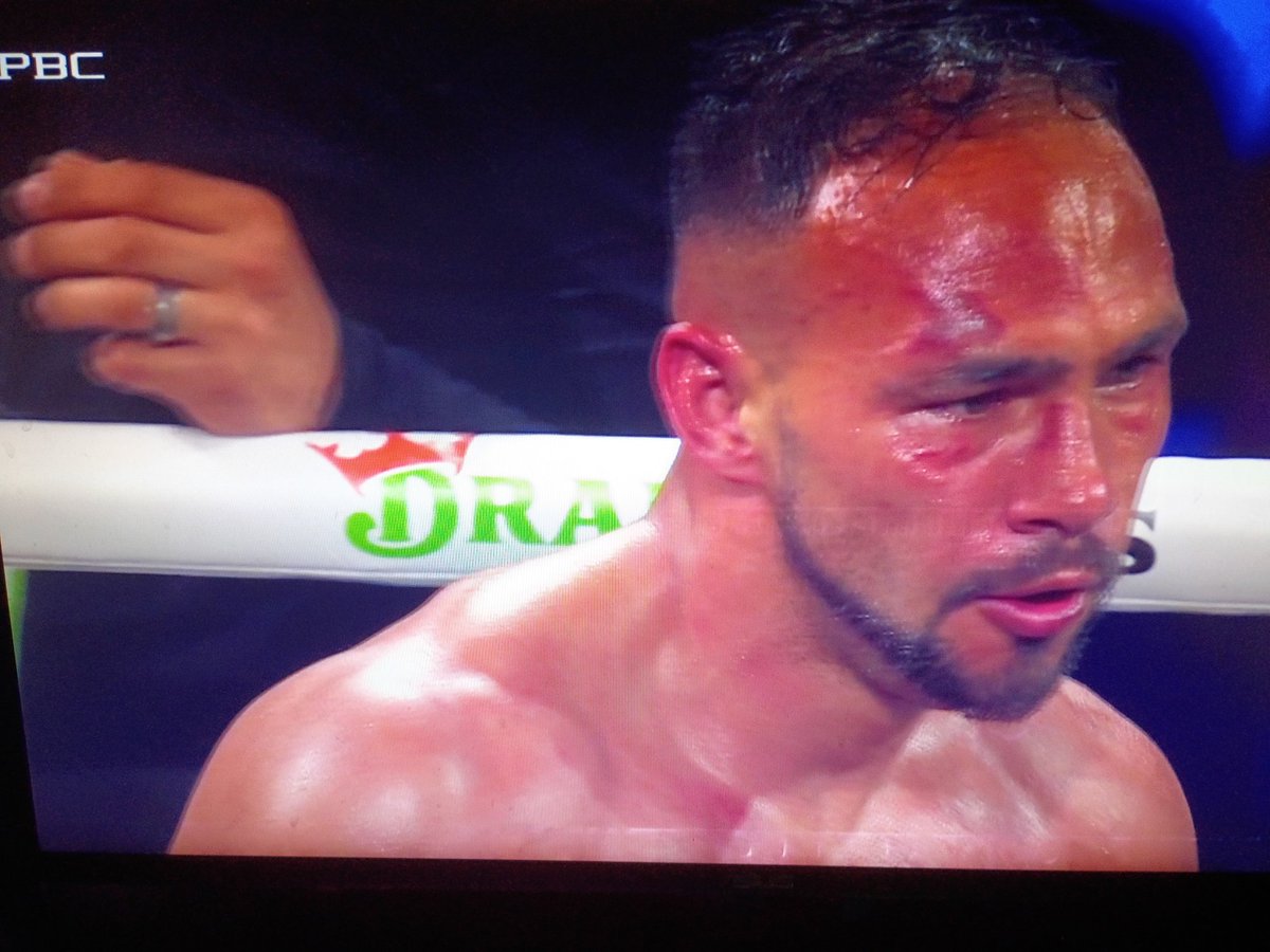 Intenxsifys's tweet image. Fundora spanked Thurman 😭