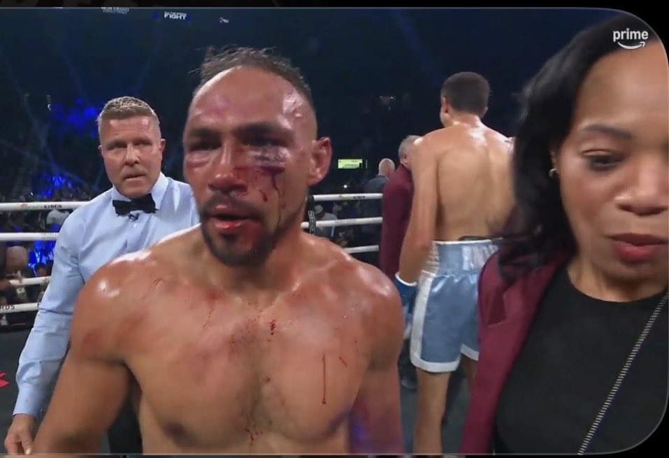 Amoringlife13's tweet image. Fundora beat the dog shit out of Thurman. I ain’t tryna hear shit about that stoppage being “too soon”.