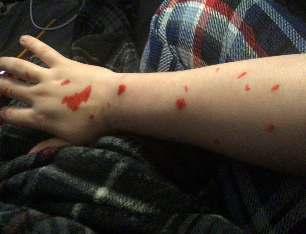 maybe weird but whenever i get upset i’ve started drawing on myself with an expo marker and highlighting all of the scars on my arms and it somehow makes me feel better