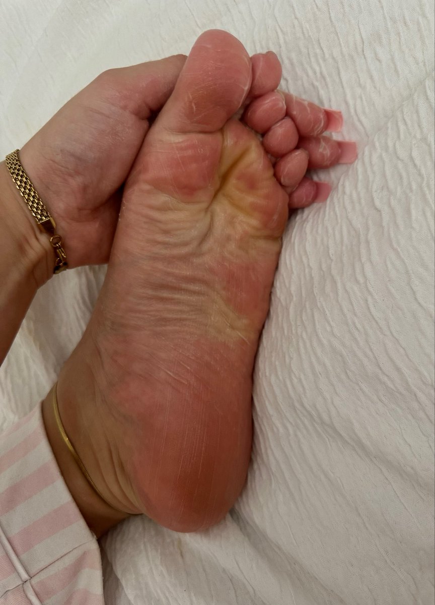 BlossomToesUK's tweet photo. Best wrinkles on X😏🩷 See the link in bio for more #feet #findom #feetfetısh #wrinklysoles #feetfun https://t.co/58gnpeTZB6