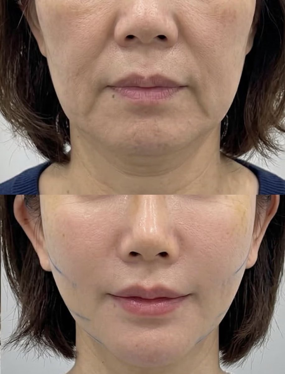 のえる tweet media