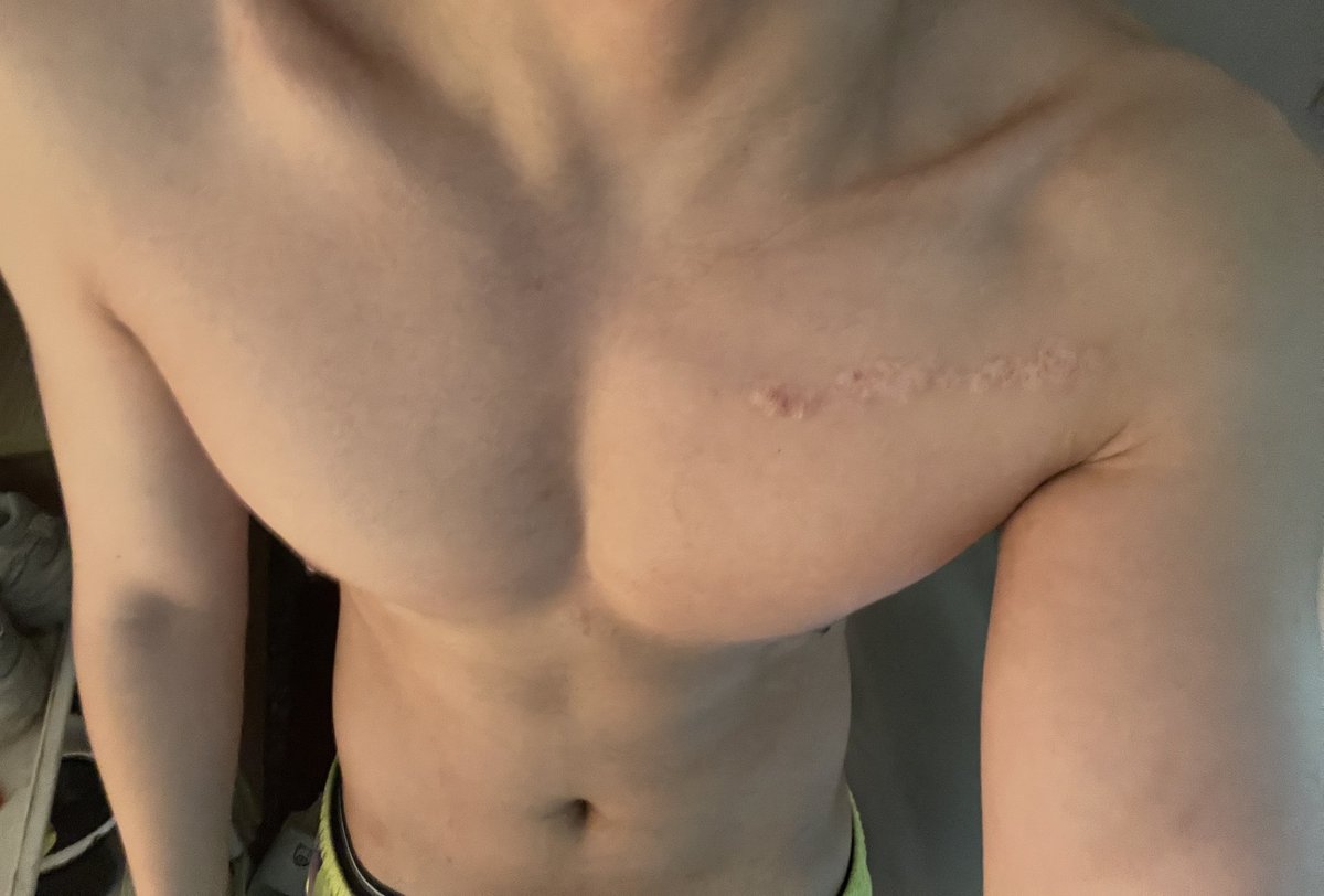 俺不中了 tweet media