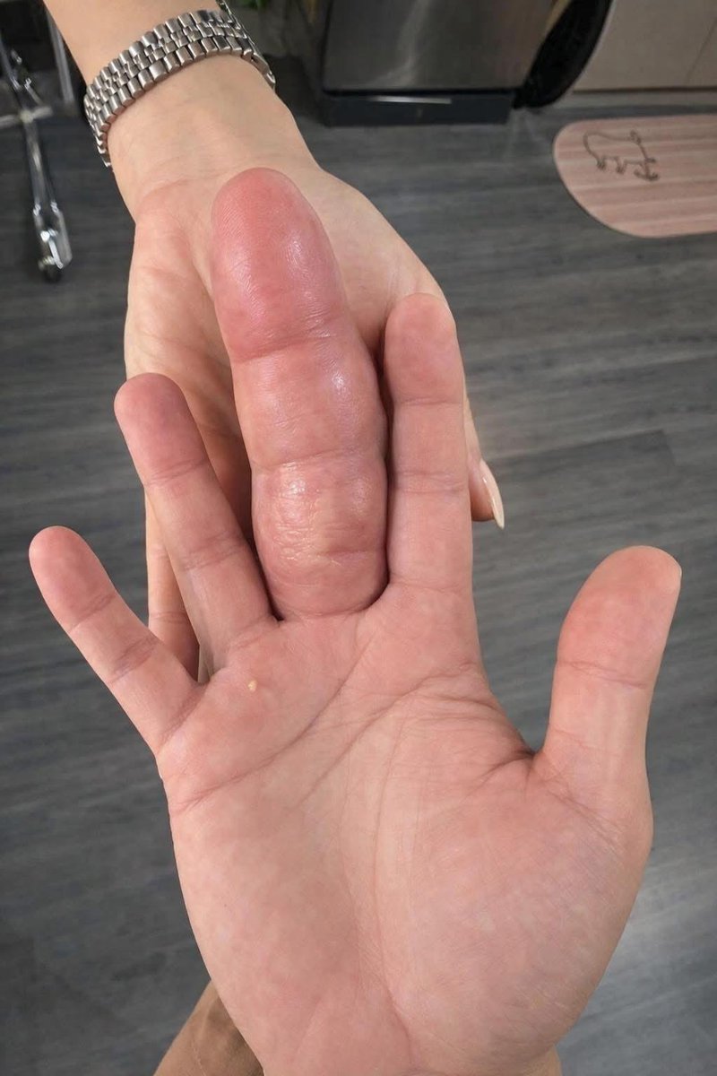 aril piterpen tweet media