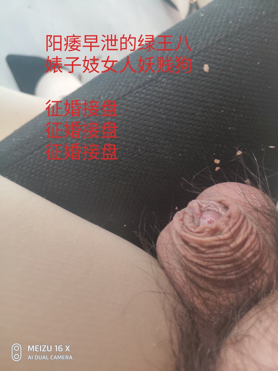 我有一阴蒂，阳痿，早泄，短小，可被绿，可接盘。