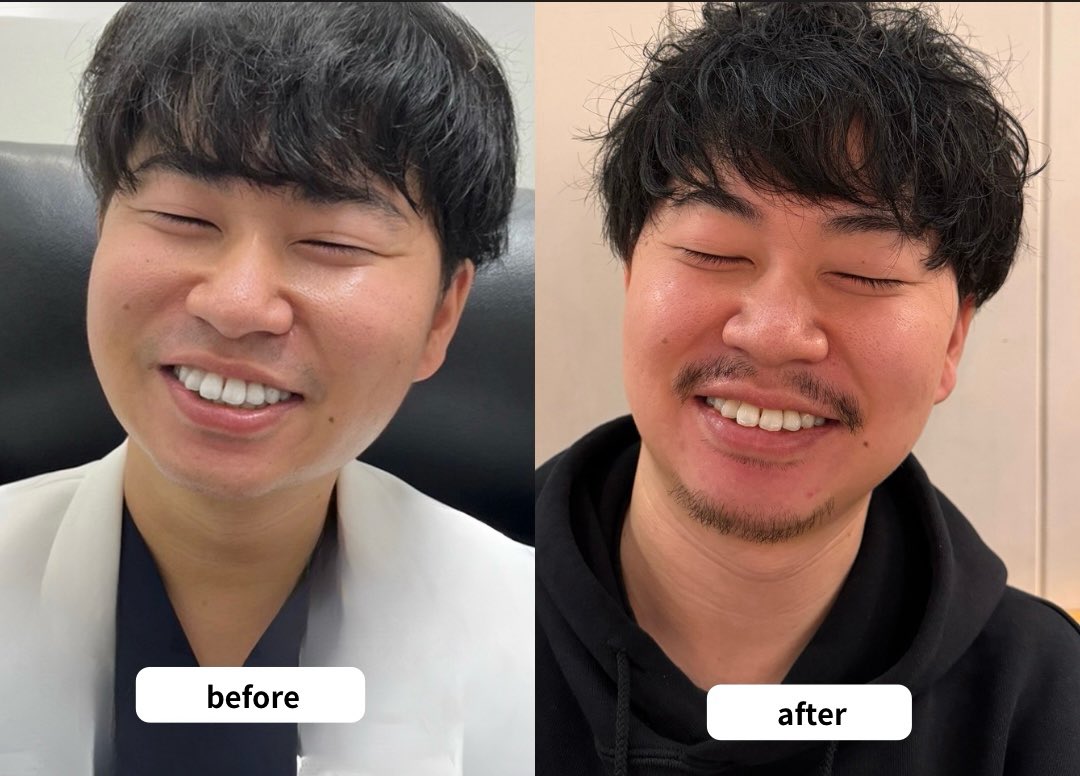 にゃんちゅう先生【脂肪吸引・脂肪吸引注射】青木　胤磨 tweet media