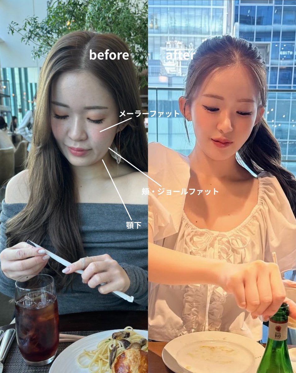 にゃんちゅう先生【脂肪吸引・脂肪吸引注射】青木　胤磨 tweet media