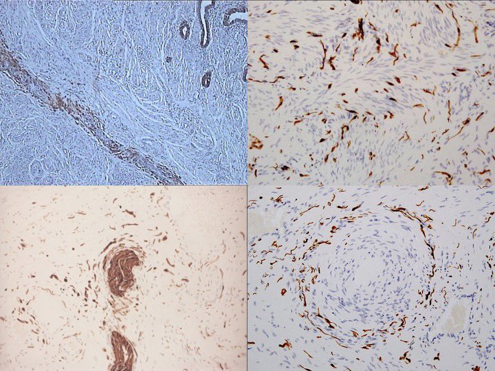 Endo Explained tweet media