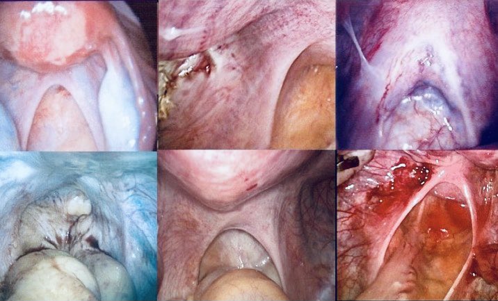 Endo Explained tweet media