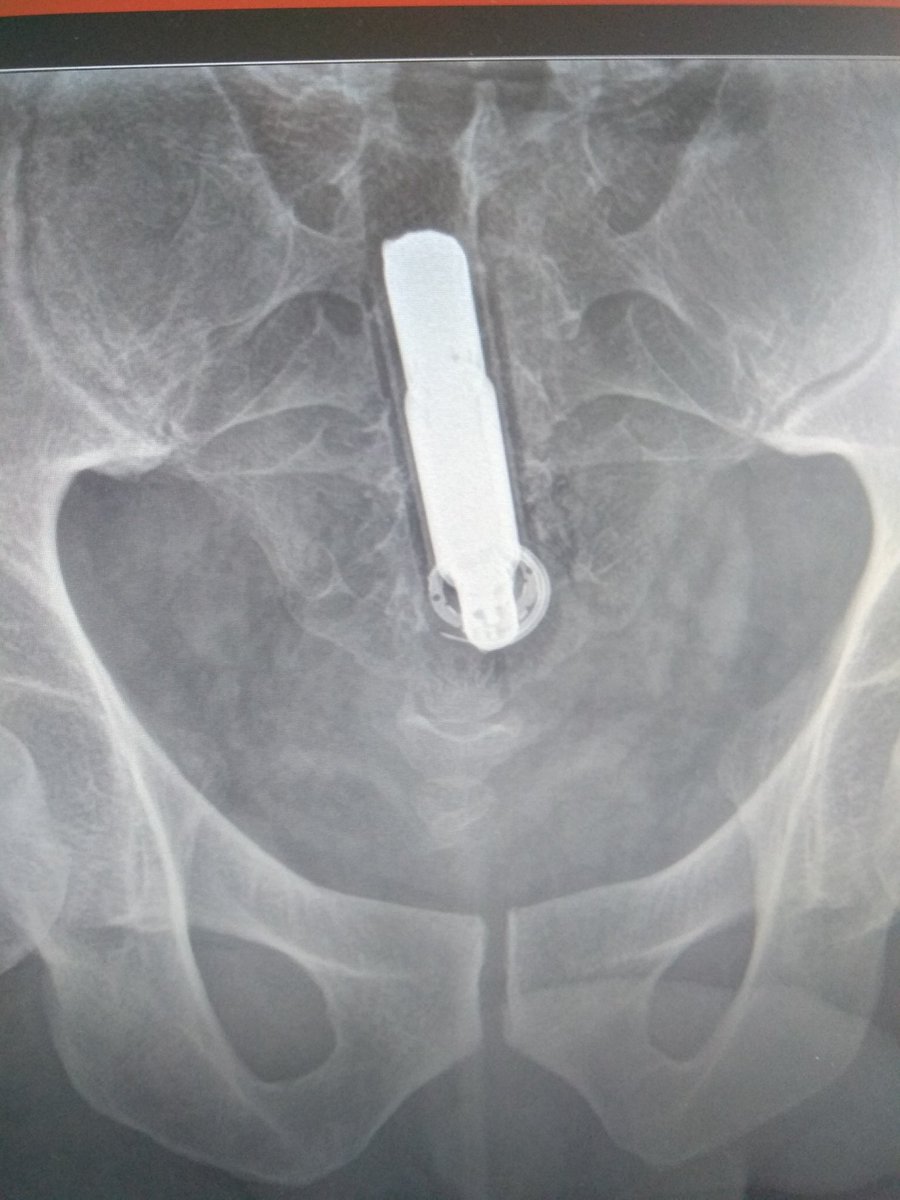 Krakoski Meszuge tweet media