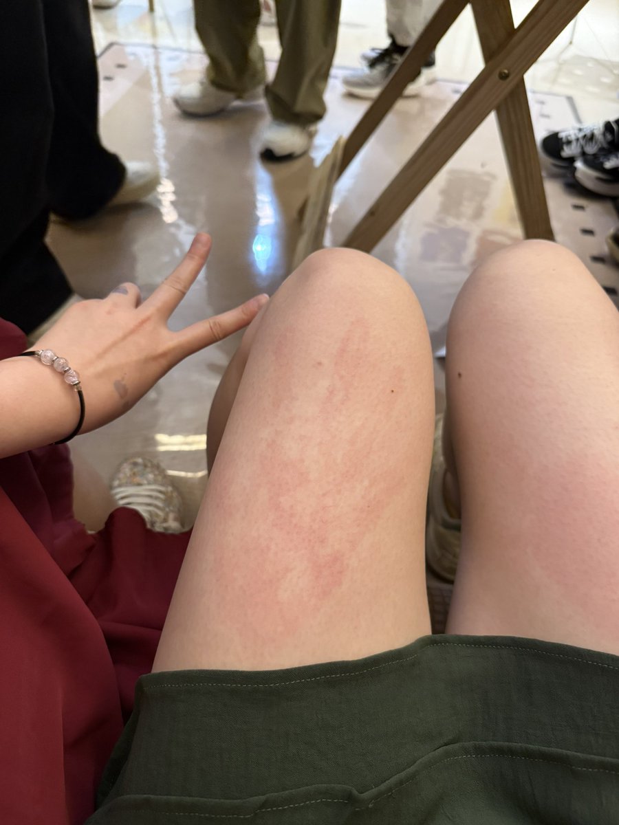 暴躁冬天天 tweet media