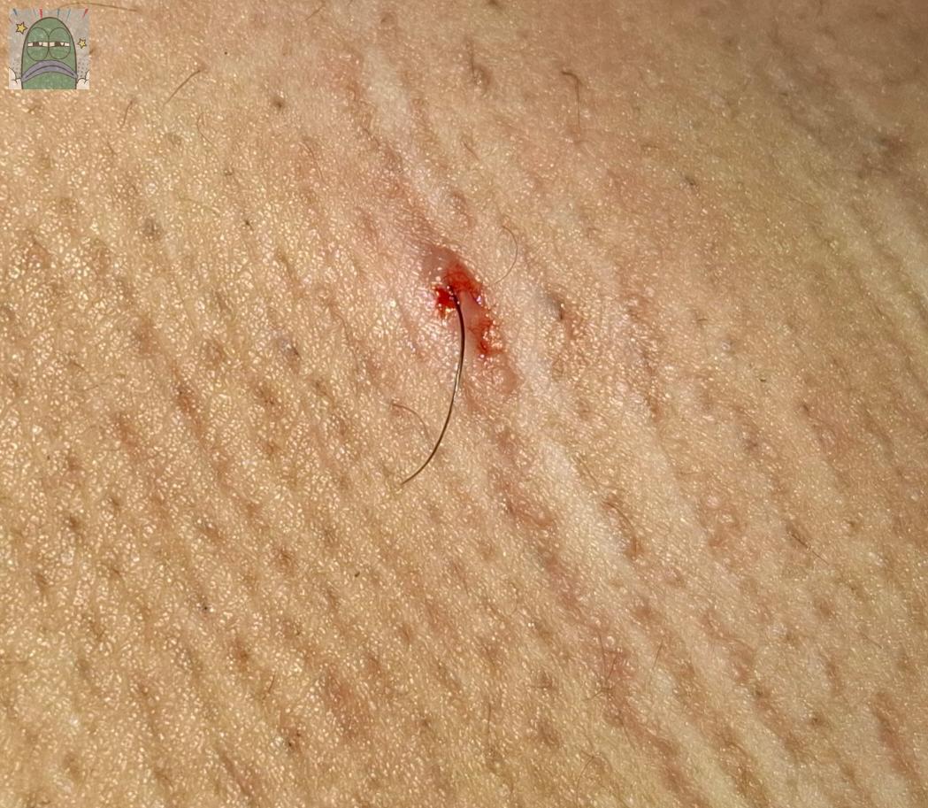 Tanyarlfes tweet media