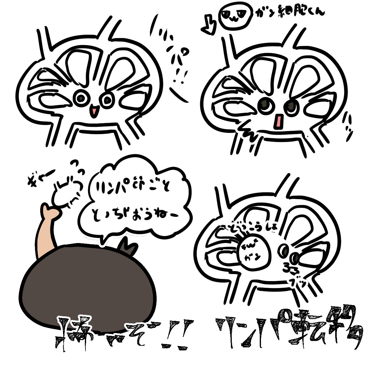 lymphman_SYR's tweet photo. 膀胱癌、直腸癌、乳癌などでは治療の一環でリンパ節郭清が行われることがあります。
大変な治療を乗り越え、やっと落ち着いた頃にリンパ浮腫を発症することも…
早期介入が大切です。むくみが気になれば早めに主治医へ相談を。 https://t.co/Rf6t46IhrS