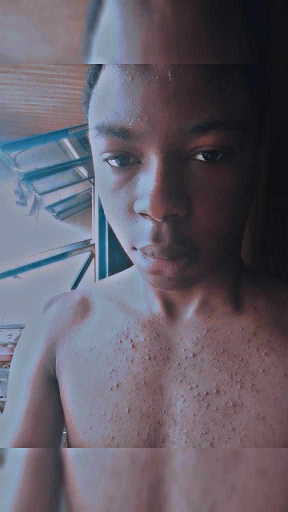 Lailak001's tweet photo. Guys please how what can I use or eat to stop this thing on my chest 

@timmyhasagoatee https://t.co/6rZOrrD2LL