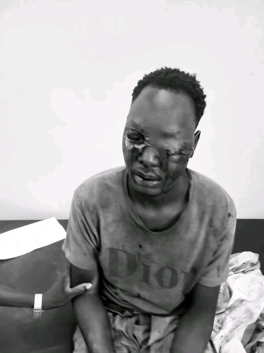 TimesJuba's tweet photo. Miner Brutally Blinded as Dozens Killed in Khor-Kaltan Massacre by SPLA-IO terrorists.

Read more details on this by clicking this link👉https://t.co/yzyenE9JcI https://t.co/HokQ3CGNSI