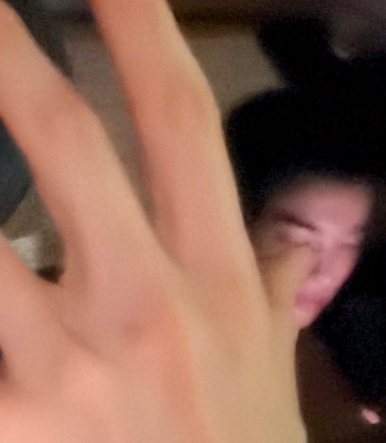 시떼루 (튀박이) tweet media