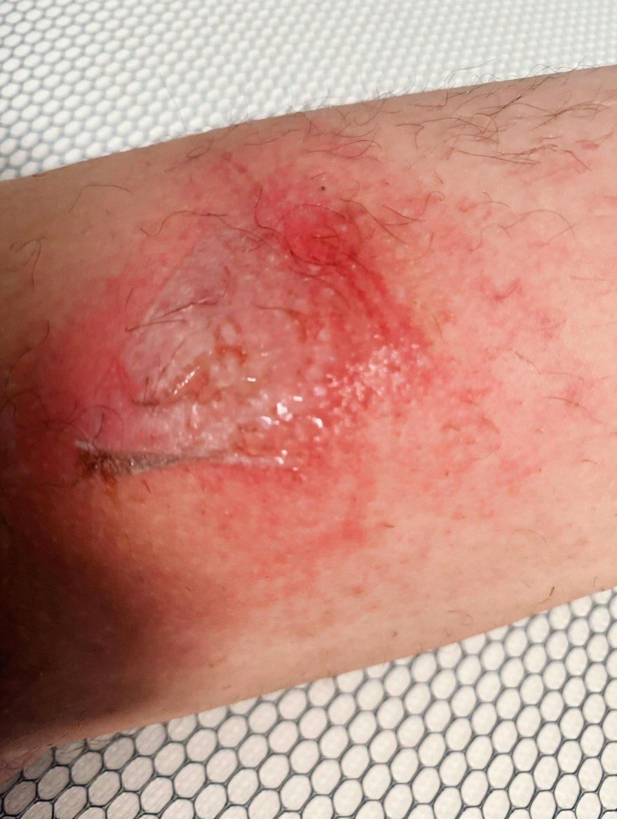 天阳教官 tweet media