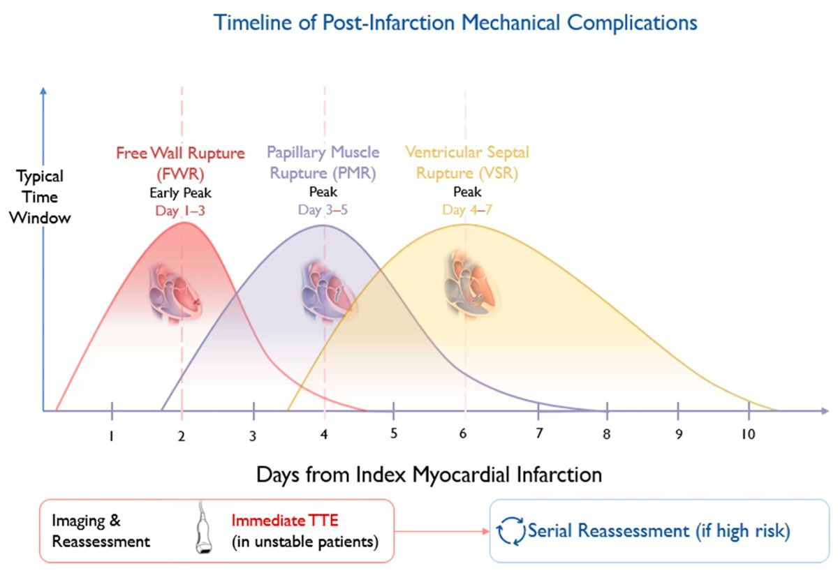 CritCareReviews's tweet photo. Mechanical Complications After Acute Myocardial Infarction: A Shock-Stage and Timing-Based Management Framework

CCR Journal Watch
https://t.co/Sp06oA6IDG https://t.co/4Xi6Gt8cIG