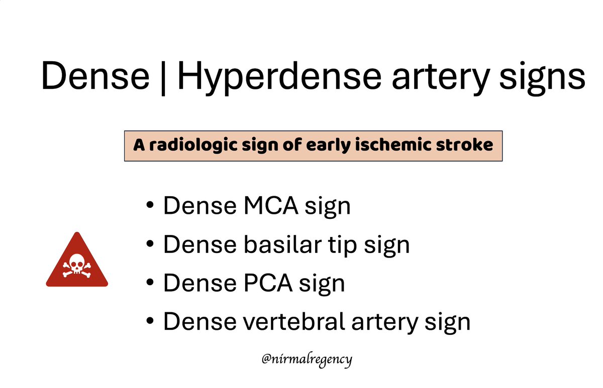 nirmalregency's tweet image. ‼️🧠🔊
Here is a quick take on the 
Hyperdense artery signs 
in Acute Ischemic #Stroke 

They have to be Hyperdense.

Inspired from a recent post on @X 
From a recent 🧑‍🏫🗣️to residents of our hospital on CT head.
🩻Source: Personal | Social media | @Radiopaedia 

🧶 ⓵ | 𝟟