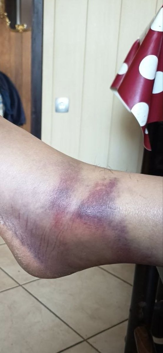 Blaž Babič tweet media