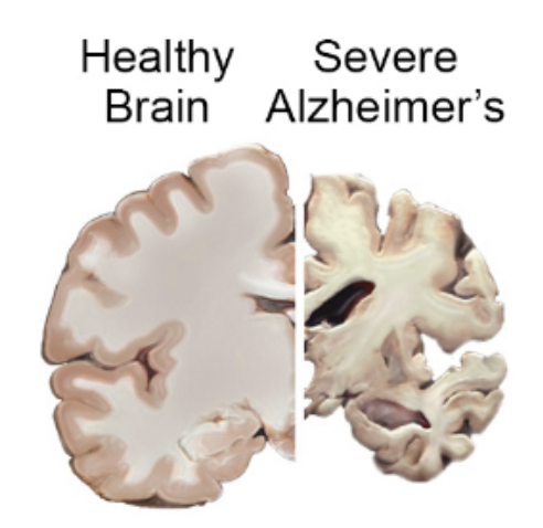 Brett Boettcher tweet media