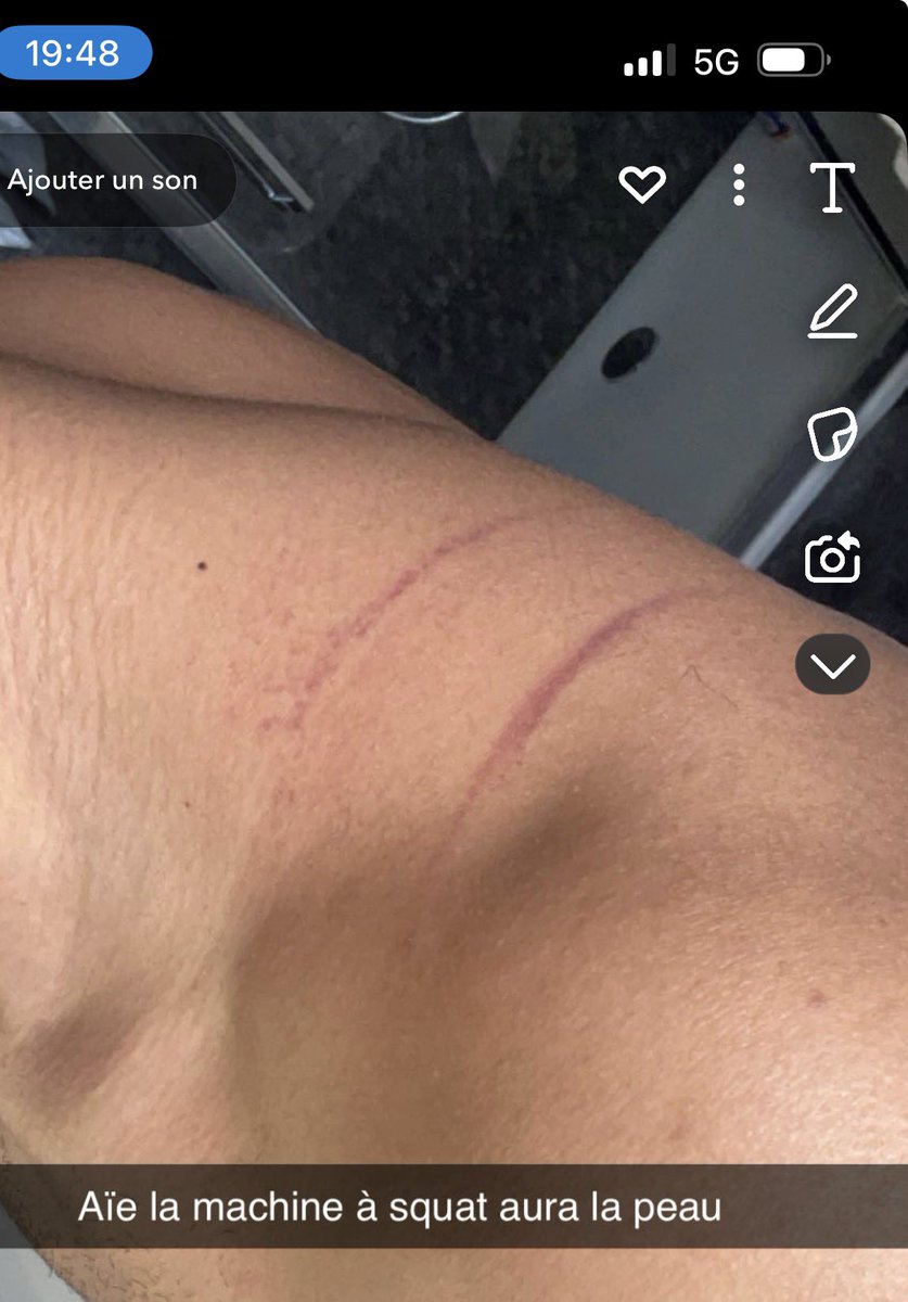 jsuisfatigué tweet media