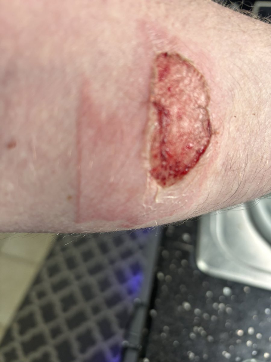 BOURNYBOY tweet media