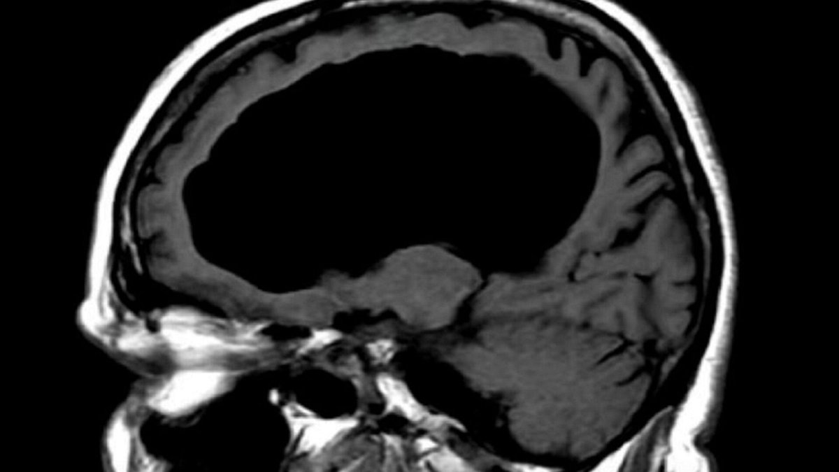 Piotr Walczyk 🇵🇱🇪🇺✌ tweet media