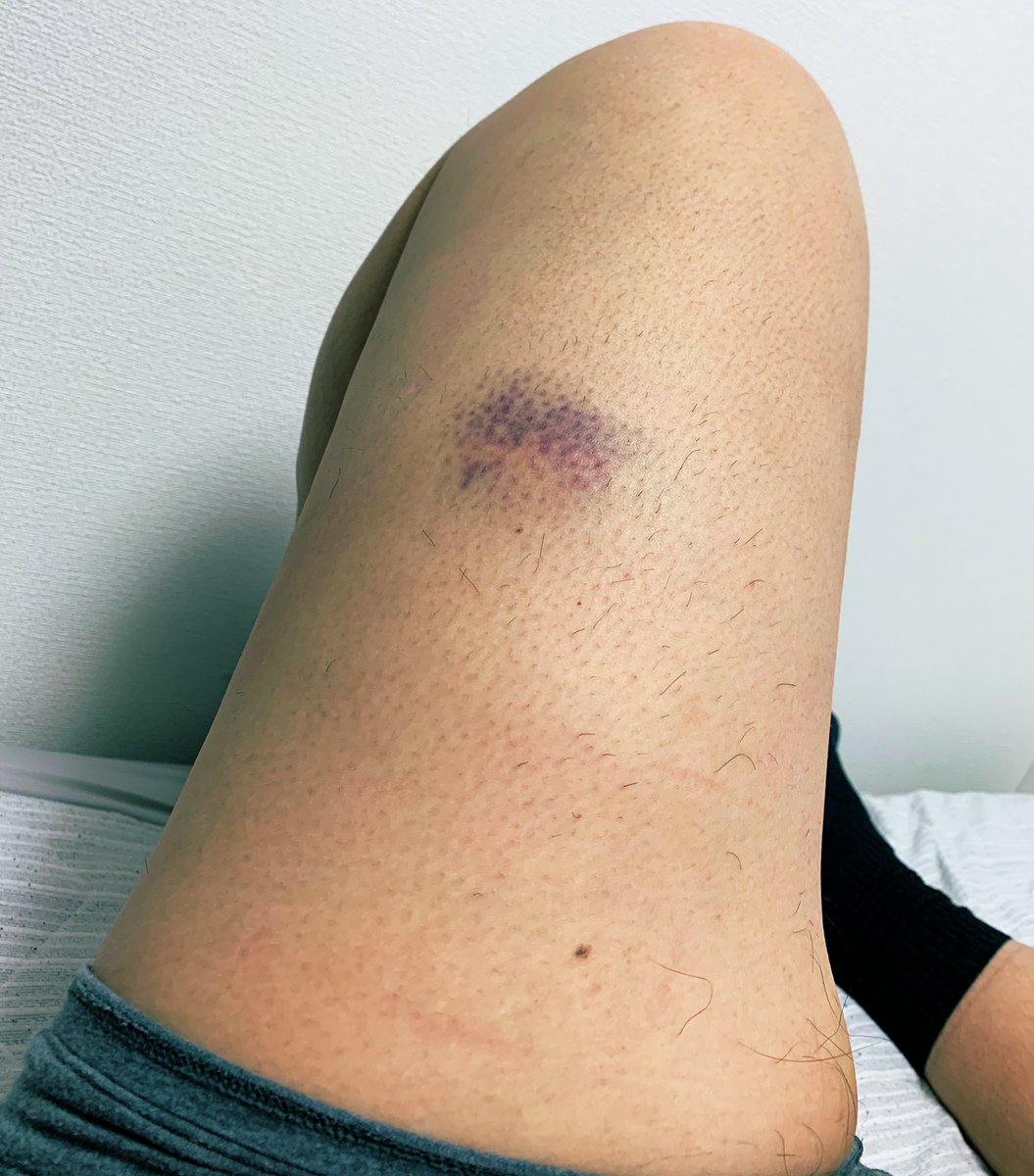 G-エルボグ44 tweet media