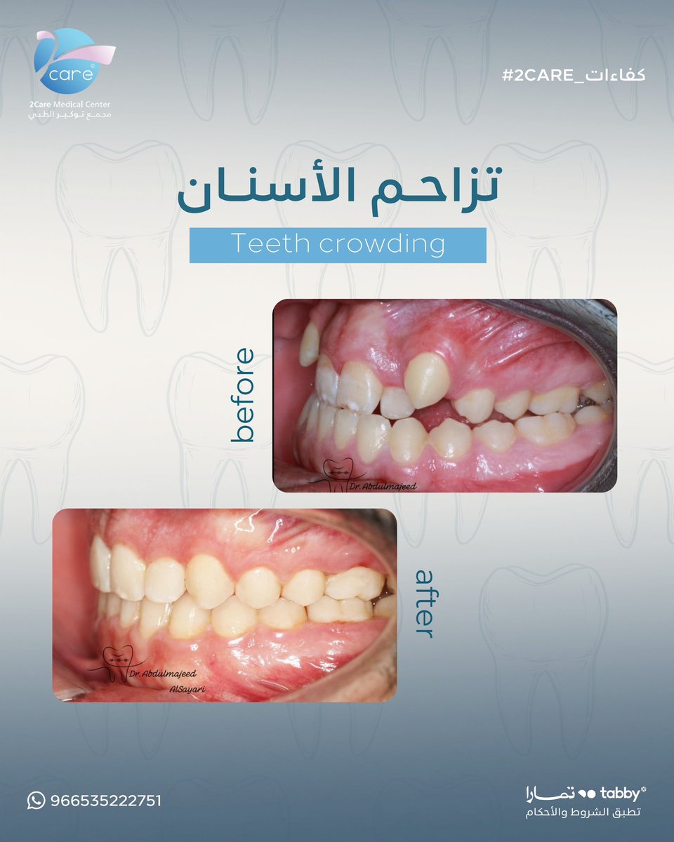مجمع توكير الطبي tweet media