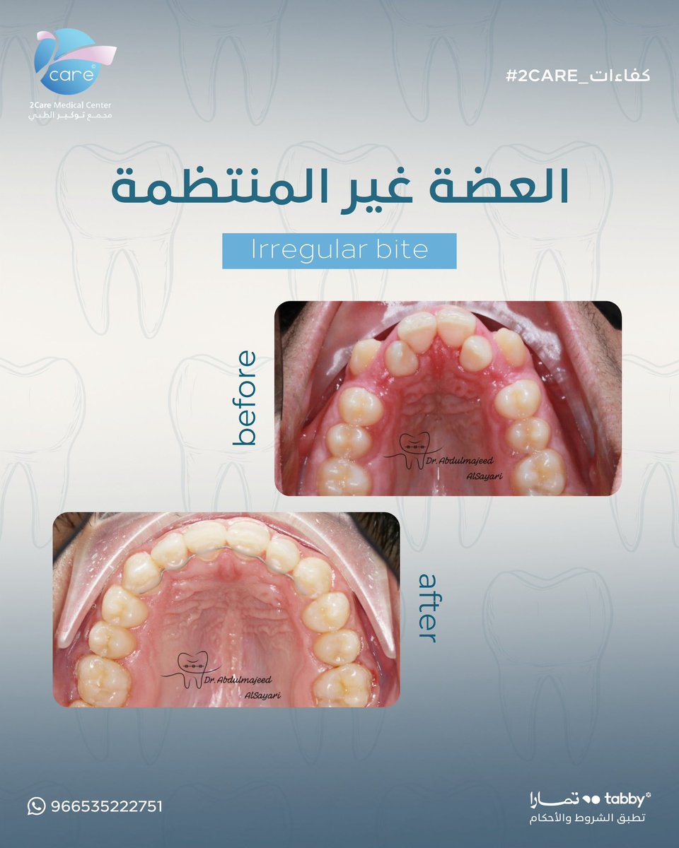 مجمع توكير الطبي tweet media