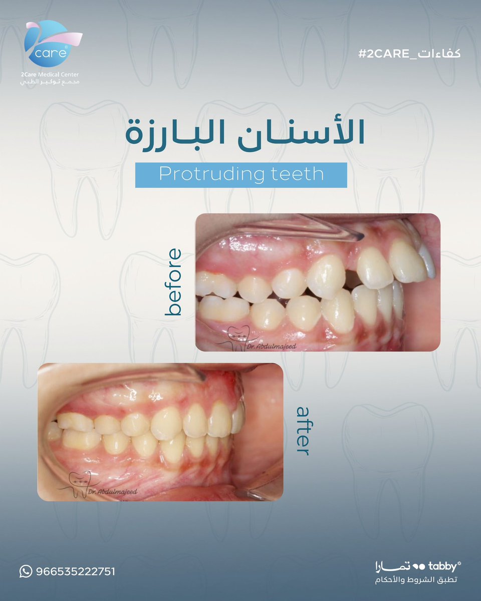 مجمع توكير الطبي tweet media