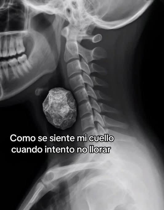 Lonely🥀 tweet media