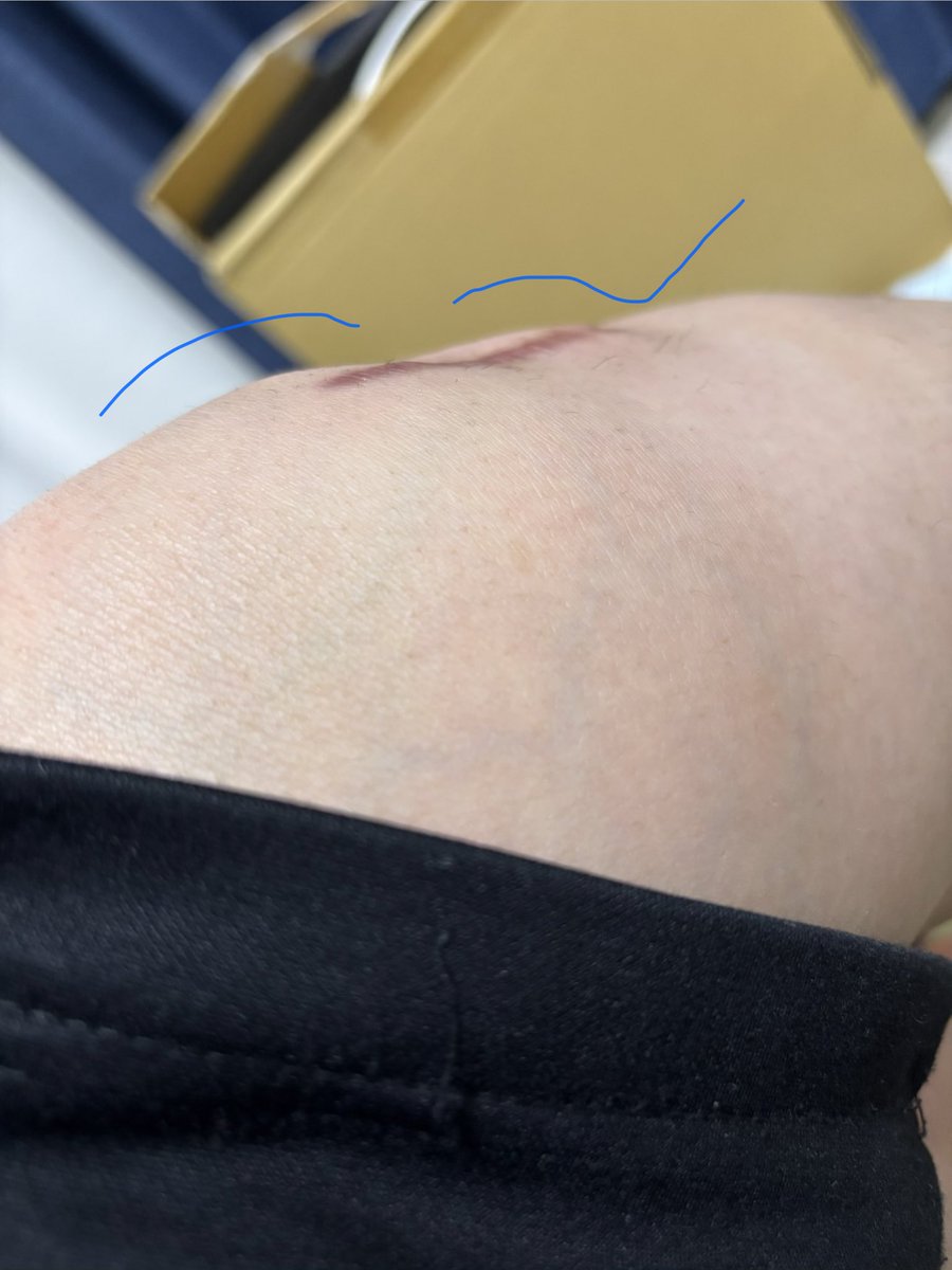 お鷲さん tweet media