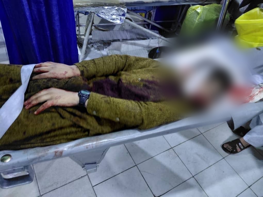 nidhisj2001's tweet image. 🚨🇦🇫💥🇵🇰
"Once again, the #Pakistani military regime militias fired mortars and other heavy weapons at Arvand rural areas and civilian homes in Asadabad, the capital of Kunar, at around 5:00 PM today, resulting in civilian casualties. Initial figures so far indicate that 16