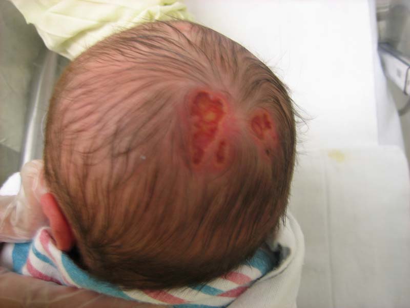 IhabFathiSulima's tweet photo. No infection.
Born this way.
What is the diagnosis⁉️ https://t.co/aVoUws8tjx
