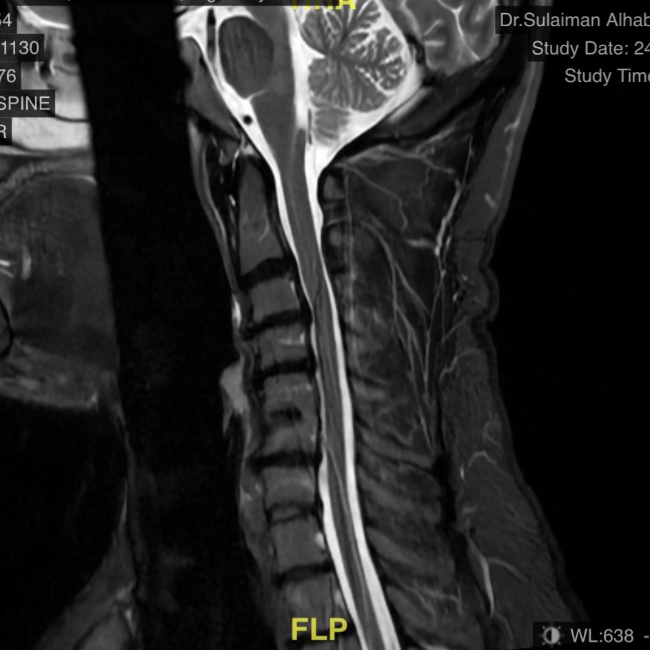تركي المريسل tweet media