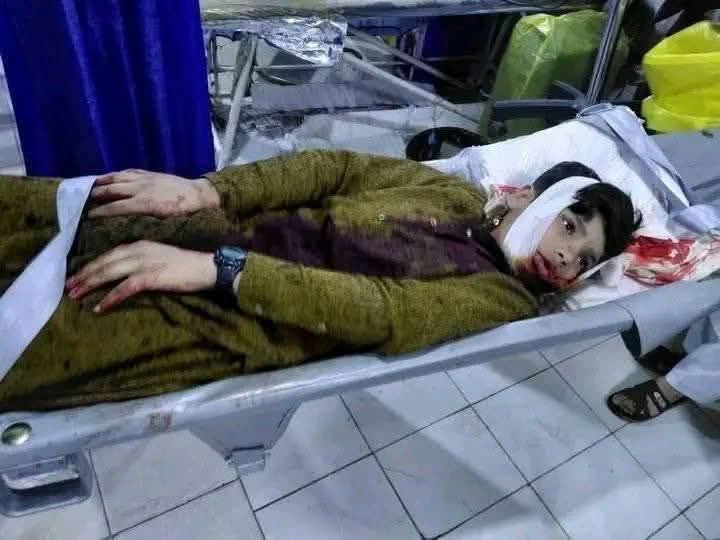 khatol_momand's tweet photo. This is the children of my country Afghanistan @hrw killed by Pakistan military attack on Kunar province. Pakistan is killing innocent civilians, it has become a second Gaza and these Pakistanis are like Israel @mfa_afghanistan @cnni @mehdirhasan please help us! @IntlCrimCourt https://t.co/1TDGFzATVq