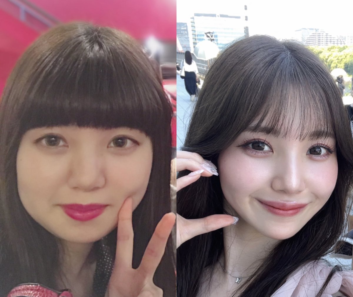 ネピちゃん/美容看護師 tweet media