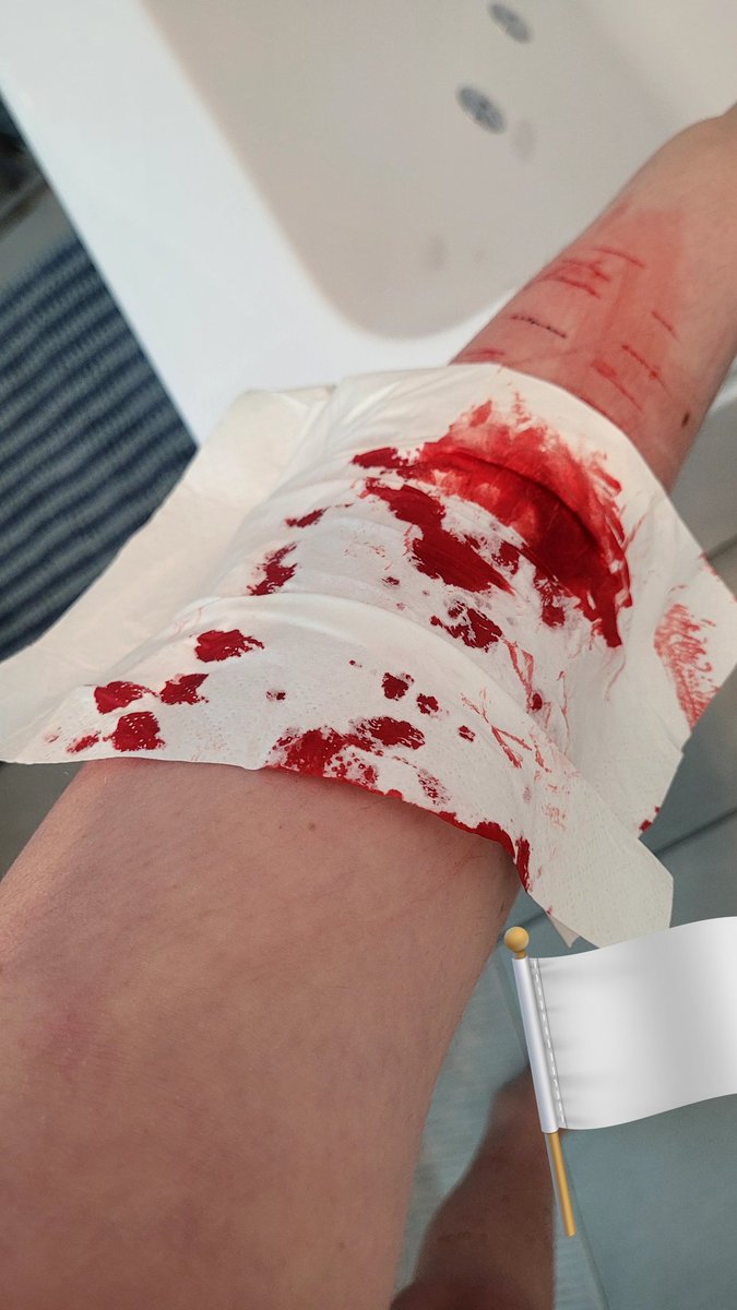 𝚛𝚎𝚗𝚖 tweet media