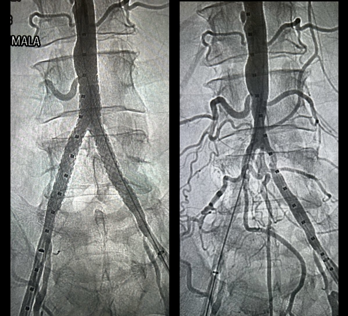 Venkat Tummala MD MBA tweet media