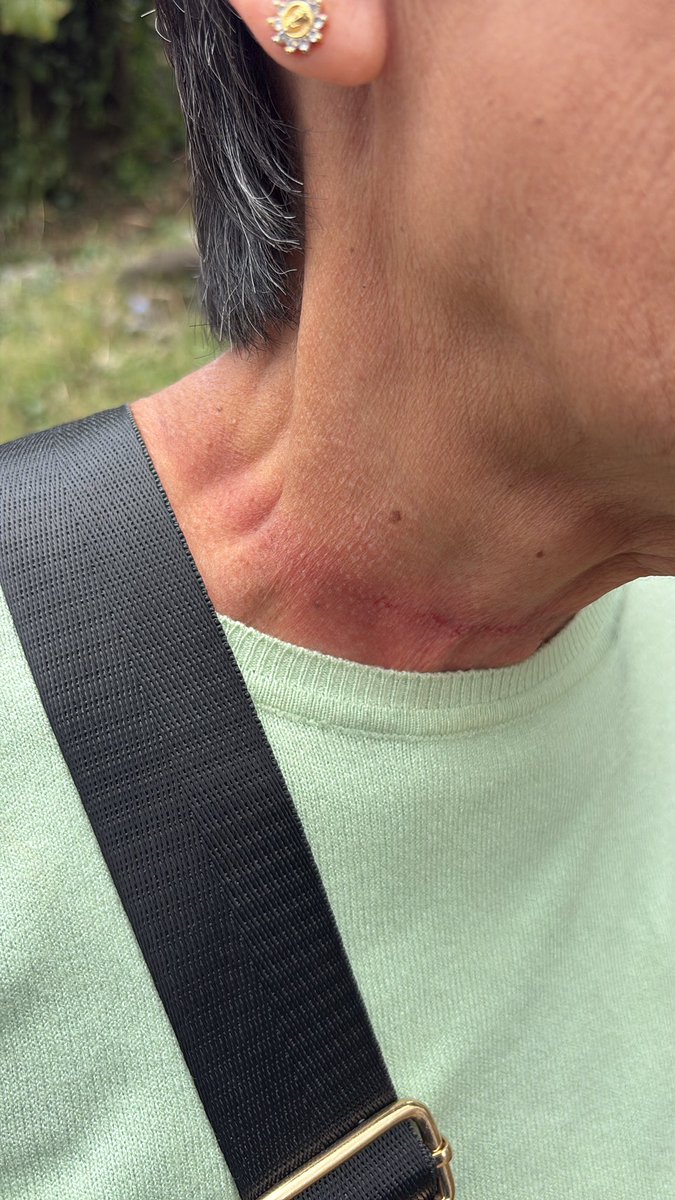 imn0tdarling's tweet photo. Amistades, tengan cuidado con estos asaltantes en la zona del dique.

Jalonearon y lastimaron a mi abuelita (una mujer de la tercera edad).

Son dos personas, una a pie y otra en moto 🚨🚨🚨🚨

#Xalapa https://t.co/INZPL1tItU