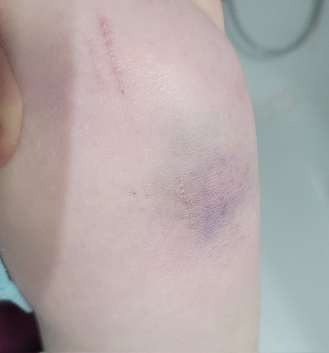 𖥔 ݁ ˖𝕴𝖛𝖆𝖓𓂃.🪓˖ ||𝚜𝚑𝚝𝚠𝚝 ᵗʳʸⁱⁿᵍ ᵗᵒ ʳᵉᶜᵒᵛ tweet media