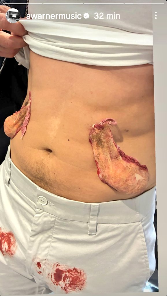 Novos stories da Amelia warner 

Bastidores do programa SNL UK na participação do Jaime Dornan