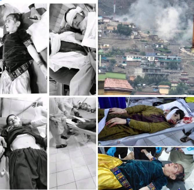 umarashna6's tweet photo. انا لله وانا الیه راجعون
نن مازیګر د پاکستان د رژیم له لوري د کونړ ولایت د اسعداباد ښار پر ملکي سیمو درنې مرمۍ وویشتل شوې. د دې برید له امله یوه ماشومه شهیده شوې او لږ تر لږه ۱۸ تنه عام ولس ټپیان شوي دي.
دا ډول بریدونه د نړیوالو قوانینو او بشري حقونو ښکاره سرغړونه ده، 
1/2 https://t.co/Qocrpm5ehO